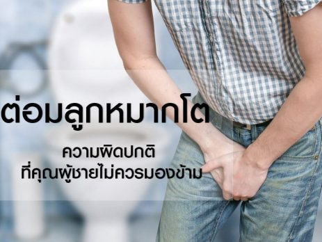 ต่อมลูกหมากโต