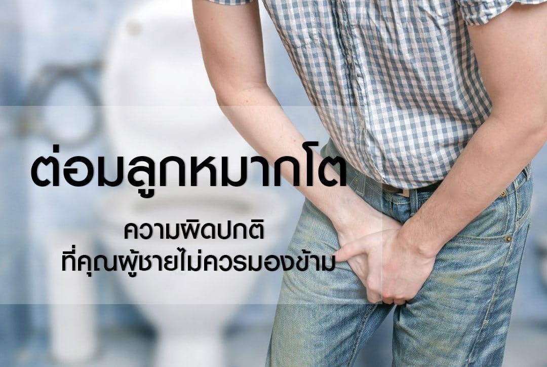 ต่อมลูกหมากโต